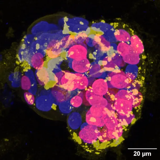 Fluorescent microscopy image of cells showing pink, blue, and green markers